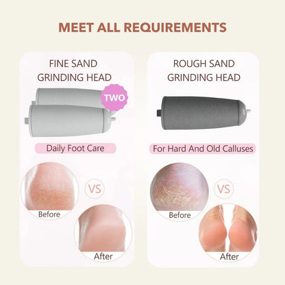 SpaSculpt Pro Pedicure & Callus Remover